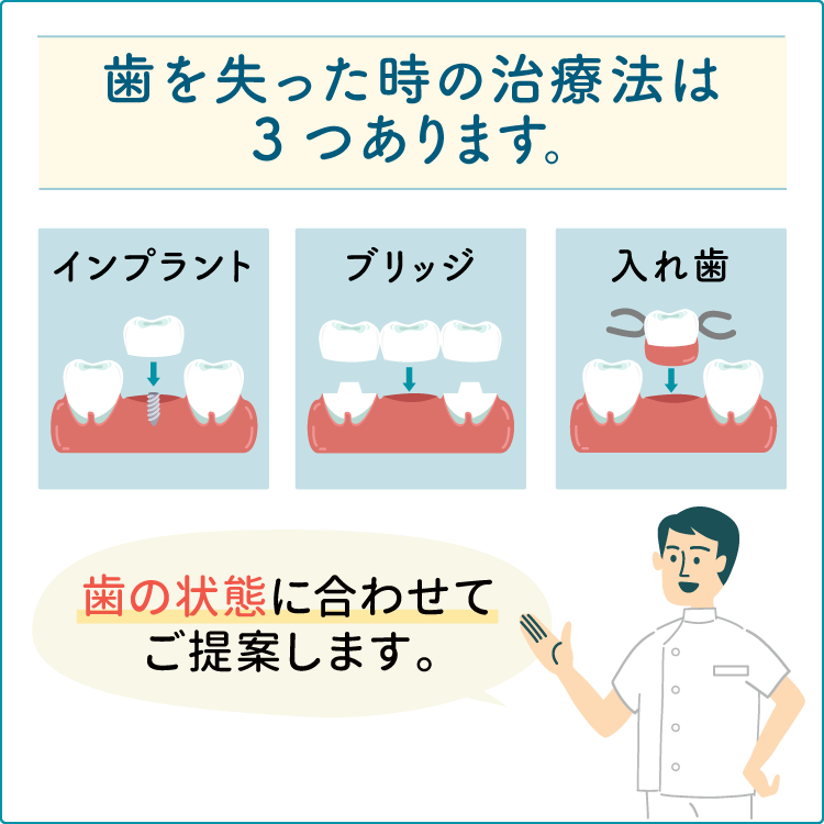 歯を失った場合はどんな治療があるの？　　～メリット・デメリット～